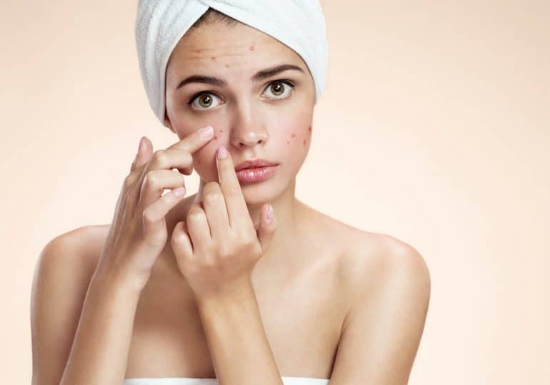 Adult acne - we suggest what lifebloods to use to enjoy a smooth complexion