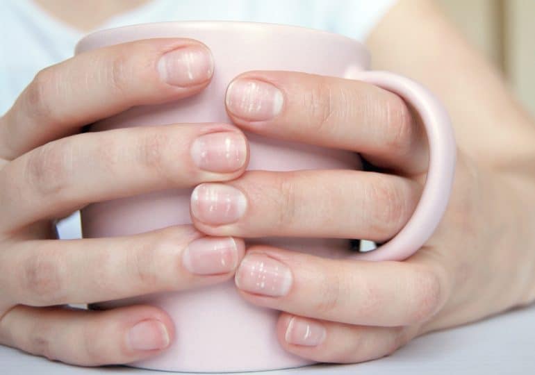 White spots on nails - is this a cause for concern?
