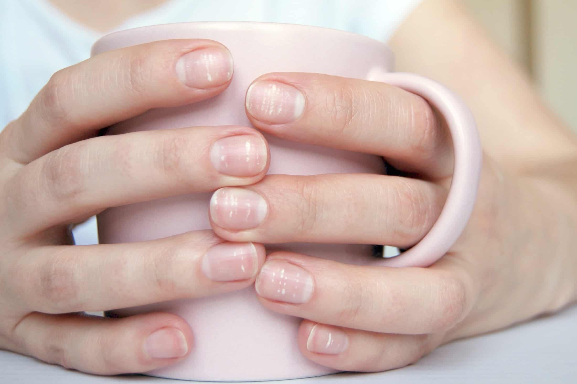 White spots on nails – is this a cause for concern?